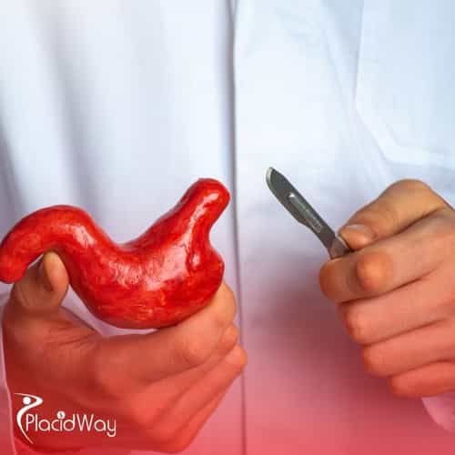 Choosing a Bariatric Surgeon in Turkey: A Checklist for UK Medical Tourists